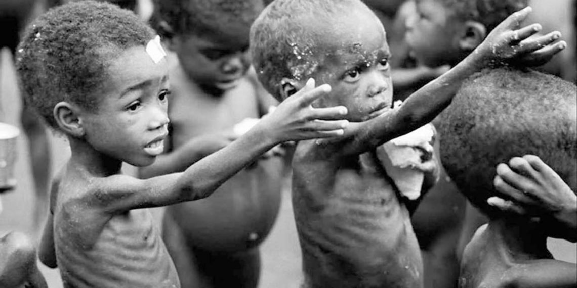 Malnutrition